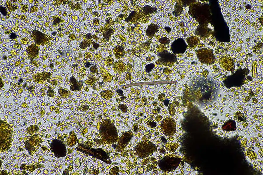 Microbes under a microscope