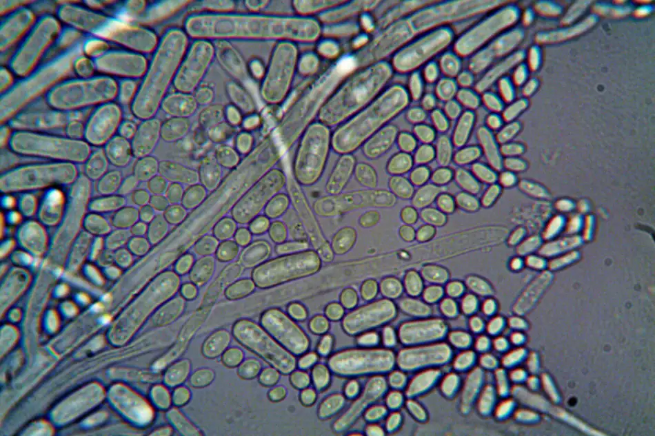 Microbes under a microscope
